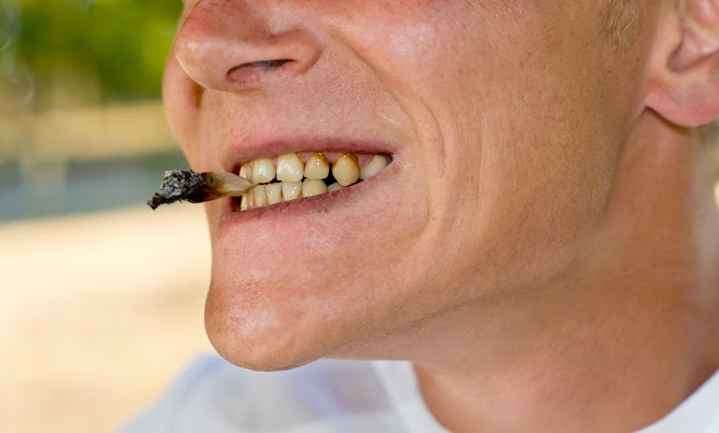 This is the image for the news article titled How Tobacco Destroys Your Mouth