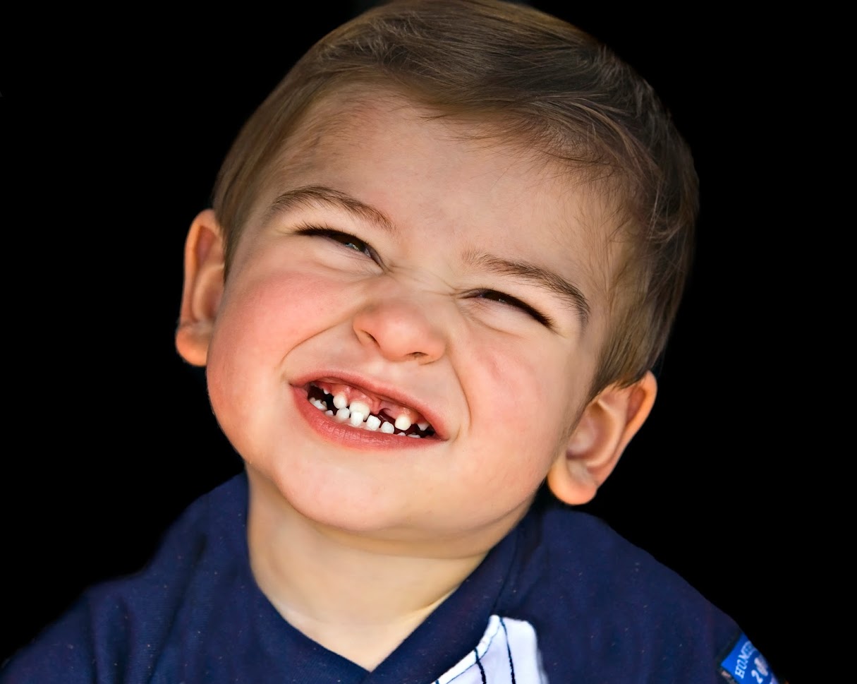 child smiling with missing tooth