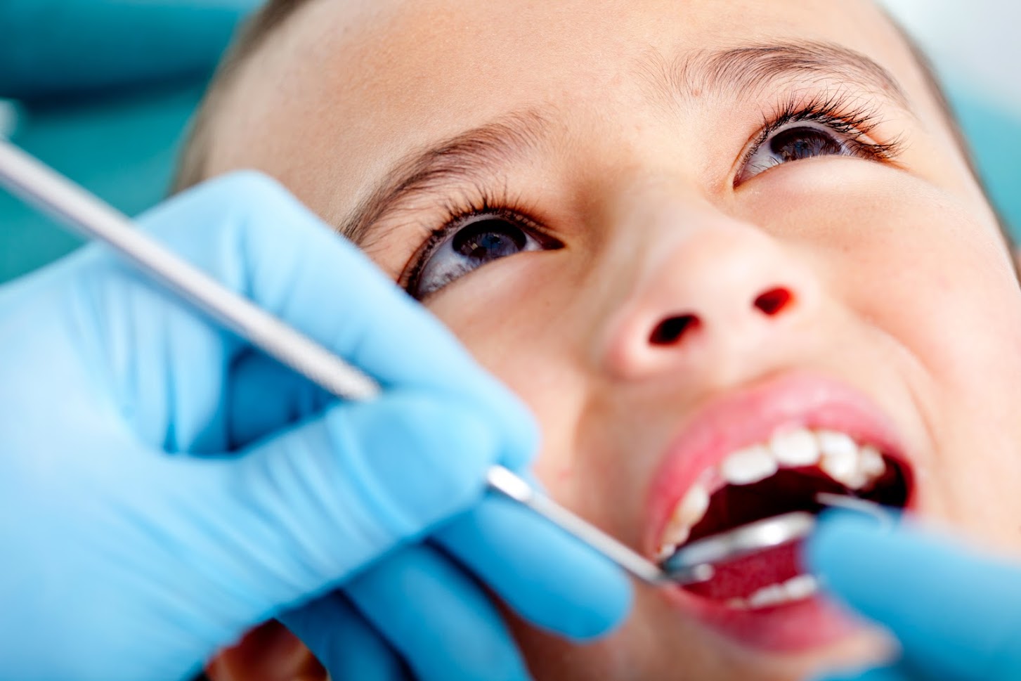 This is the image for the news article titled Does Your Child's Oral Health Show Stress-Related Signs?