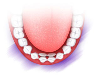 Two-Sets-of-Teeth.jpg